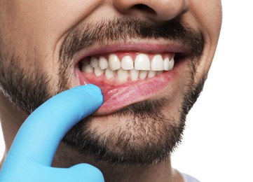 Man showing healthy gums on white background, closeup