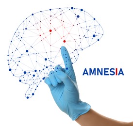 Image of Amnesia therapy. Doctor in blue latex gloves pointing at human brain illustration on white background, closeup 