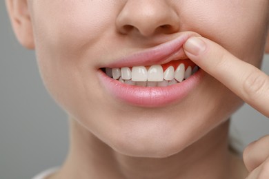 Woman showing inflamed gum on grey background, closeup