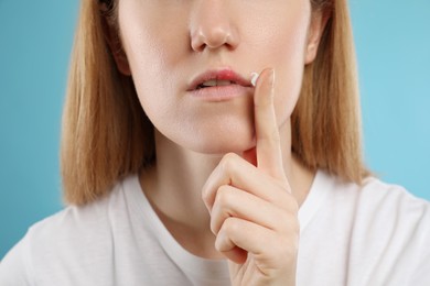 Photo of Woman with herpes applying cream on lips against light blue background, closeup