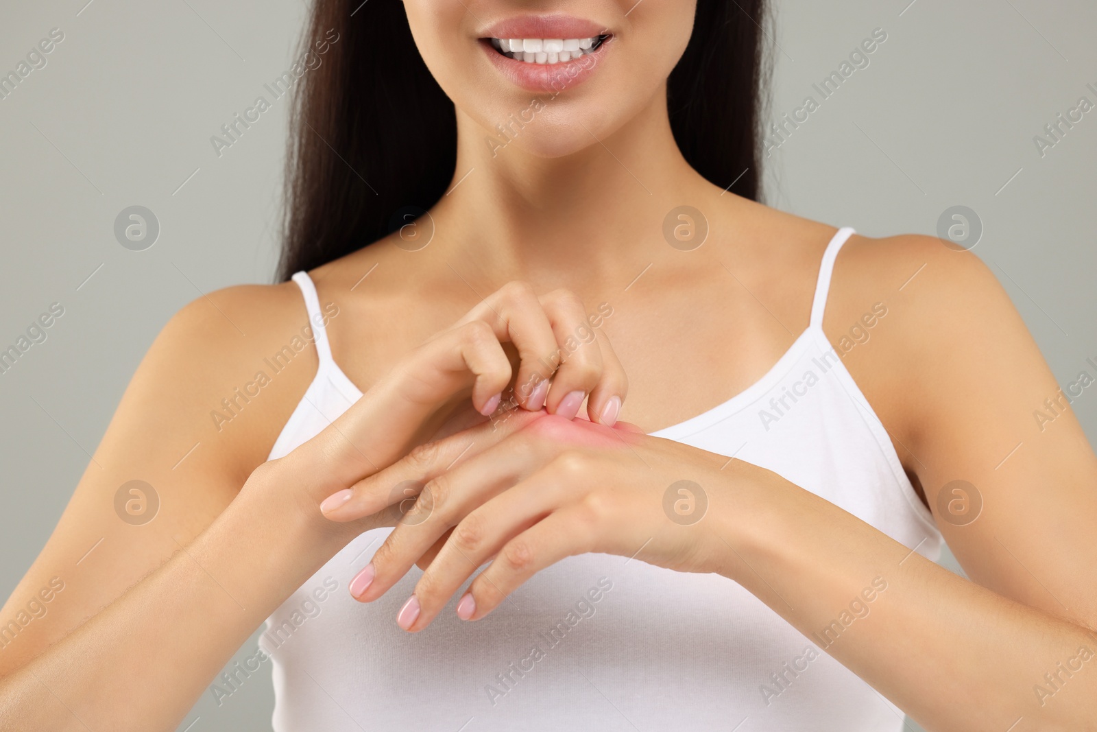 Photo of Suffering from allergy. Young woman scratching her hand on light grey background, closeup