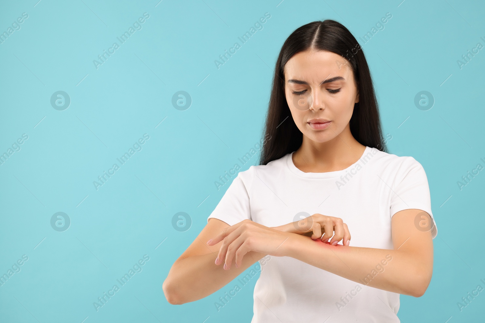 Photo of Suffering from allergy. Young woman scratching her arm on light blue background. Space for text