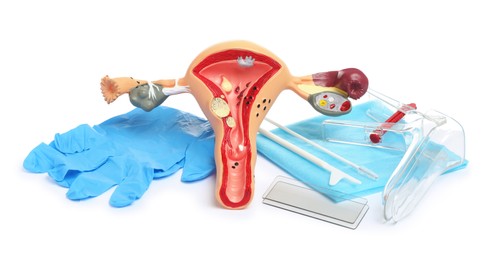 Model of female reproductive system and gynecological examination kit on white background