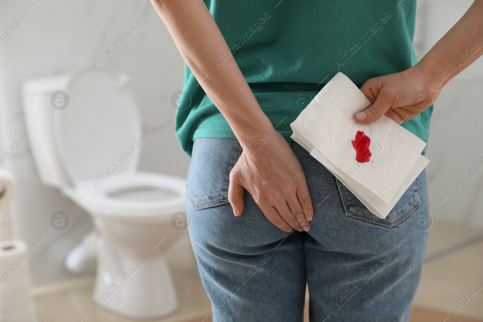 Photo of Woman holding toilet paper with blood stain in rest room, closeup. Hemorrhoid concept