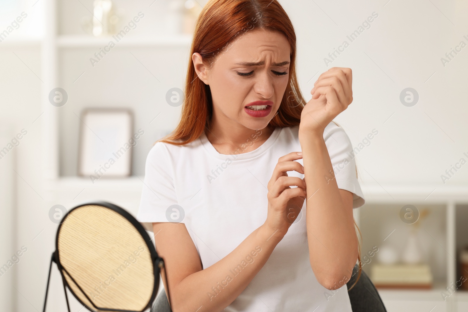 Photo of Suffering from allergy. Young woman scratching her arm at home