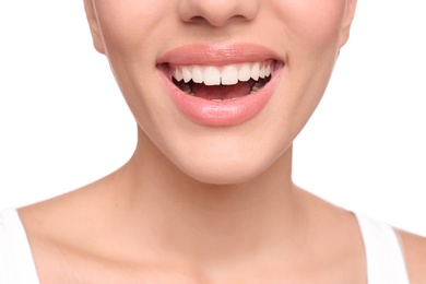 Young woman with beautiful smile on white background, closeup. Teeth whitening