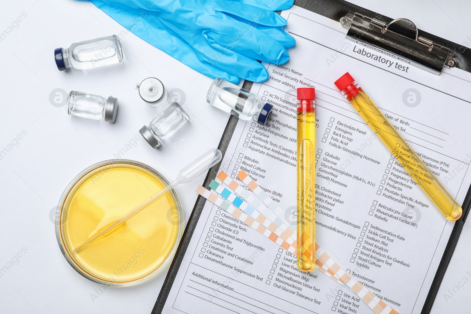 Photo of Flat lay composition with laboratory equipment and urine samples on light background. Urology concept