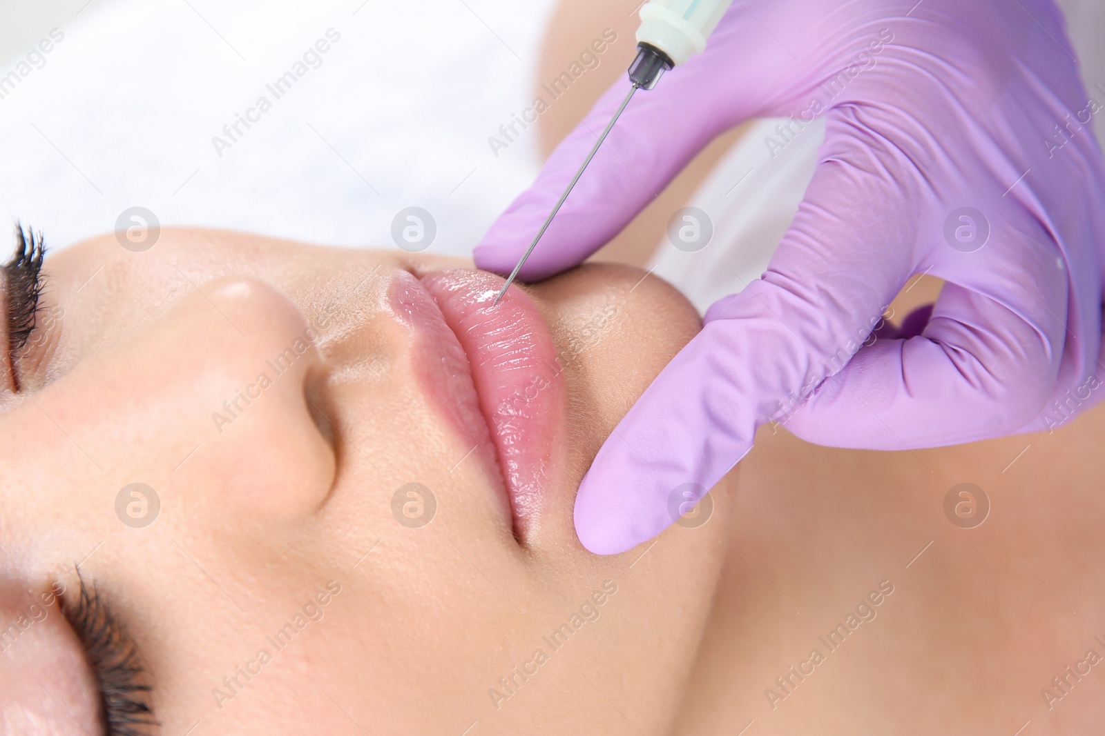 Photo of Young woman getting lip injection in beautician salon, closeup