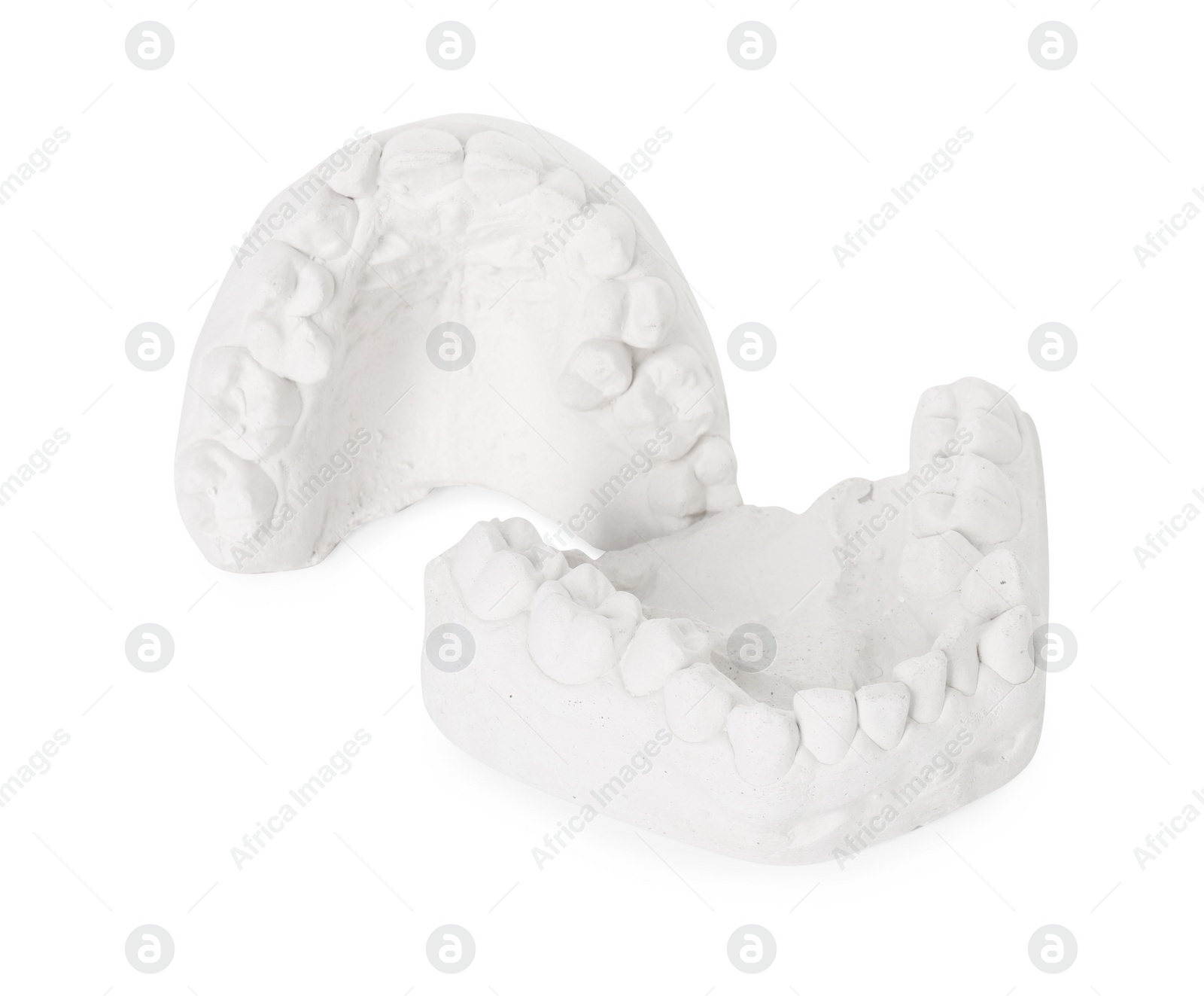 Photo of Dental model with gums isolated on white. Cast of teeth