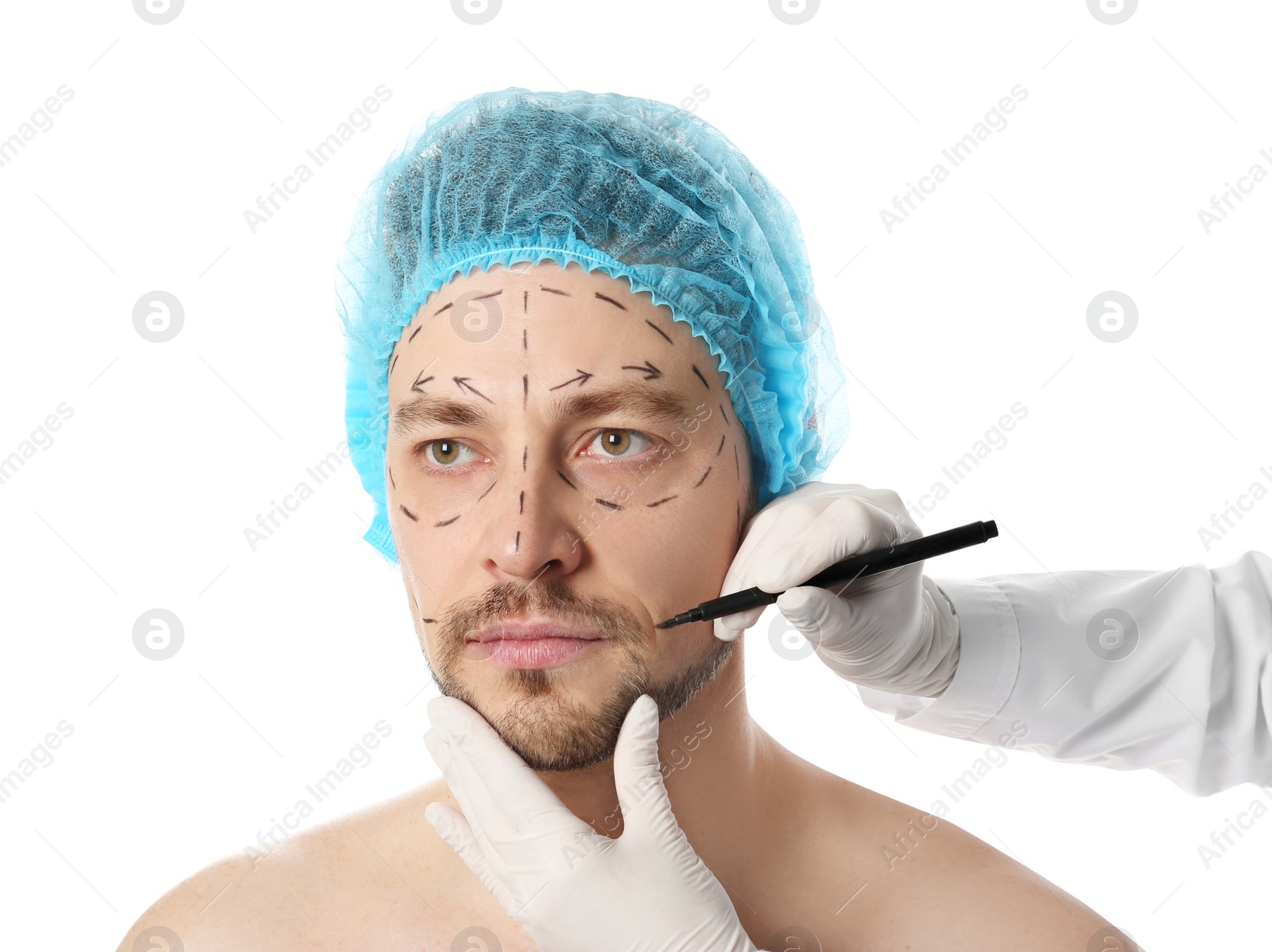 Photo of Doctor drawing marks on man's face for cosmetic surgery operation against white background