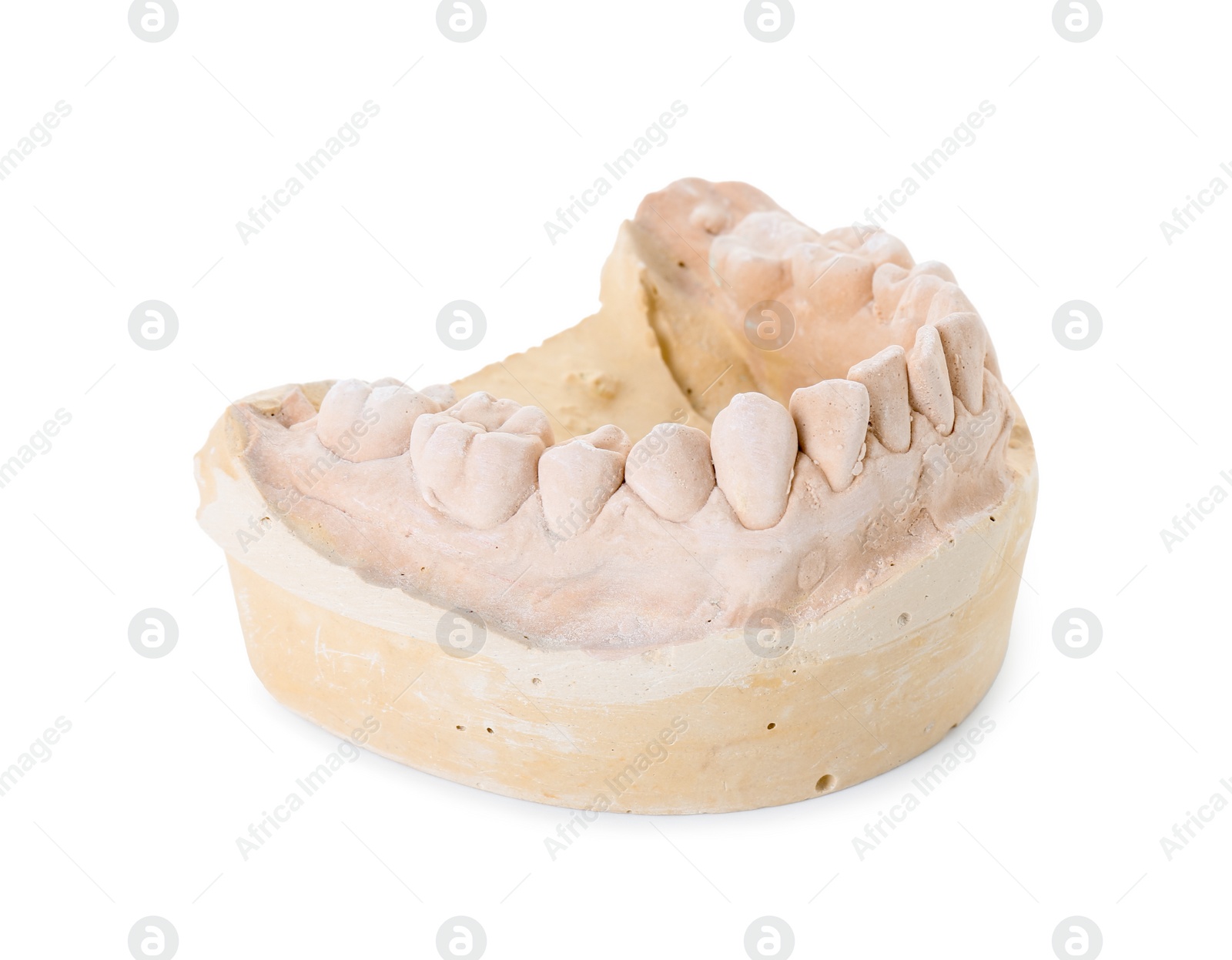 Photo of Dental model with jaw isolated on white. Cast of teeth