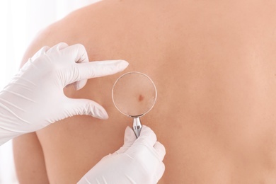 Dermatologist examining patient with magnifying glass in clinic, closeup view