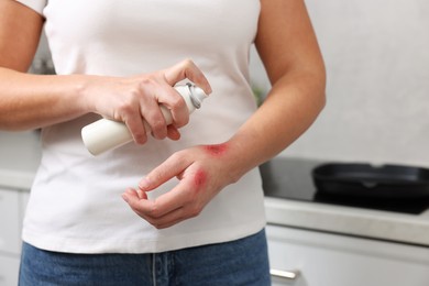 Photo of Woman applying panthenol onto burns on her hand in kitchen, closeup. Space for text