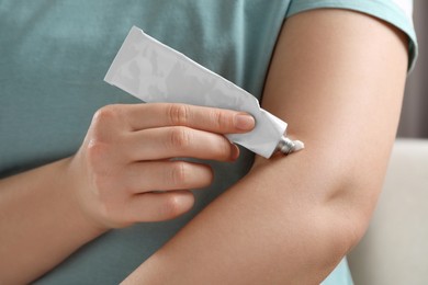 Photo of Woman applying ointment from tube onto her arm indoors, closeup