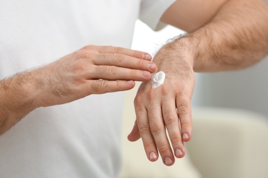 Photo of Man applying cream onto hand on blurred background, closeup