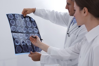 Doctors examining MRI images of patient with multiple sclerosis in clinic