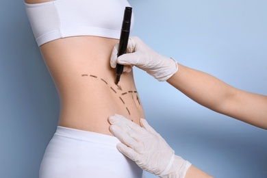Photo of Doctor drawing marks on female belly for cosmetic surgery operation against color background