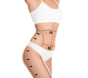 Image of Slim young woman with marks on body for cosmetic surgery operation against white background, closeup