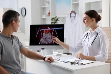 Gastroenterologist showing screen with illustration of digestive tract to patient at table in clinic