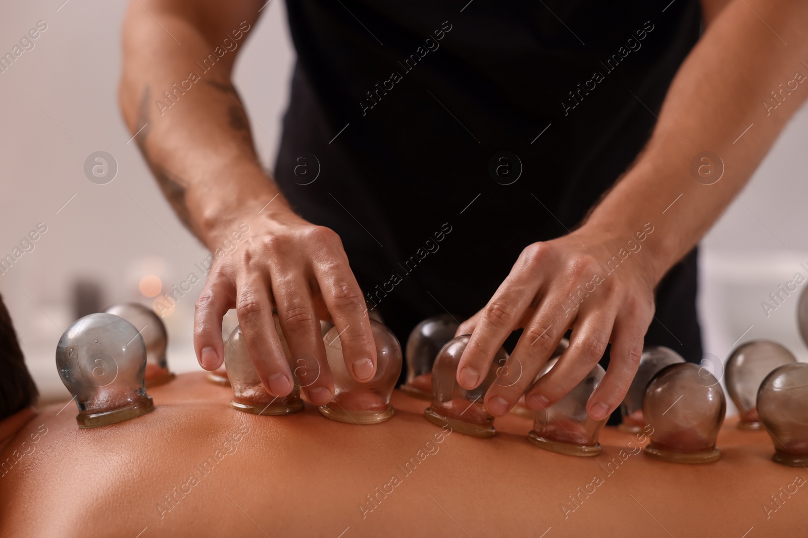 Photo of Therapist giving cupping treatment to patient indoors, closeup