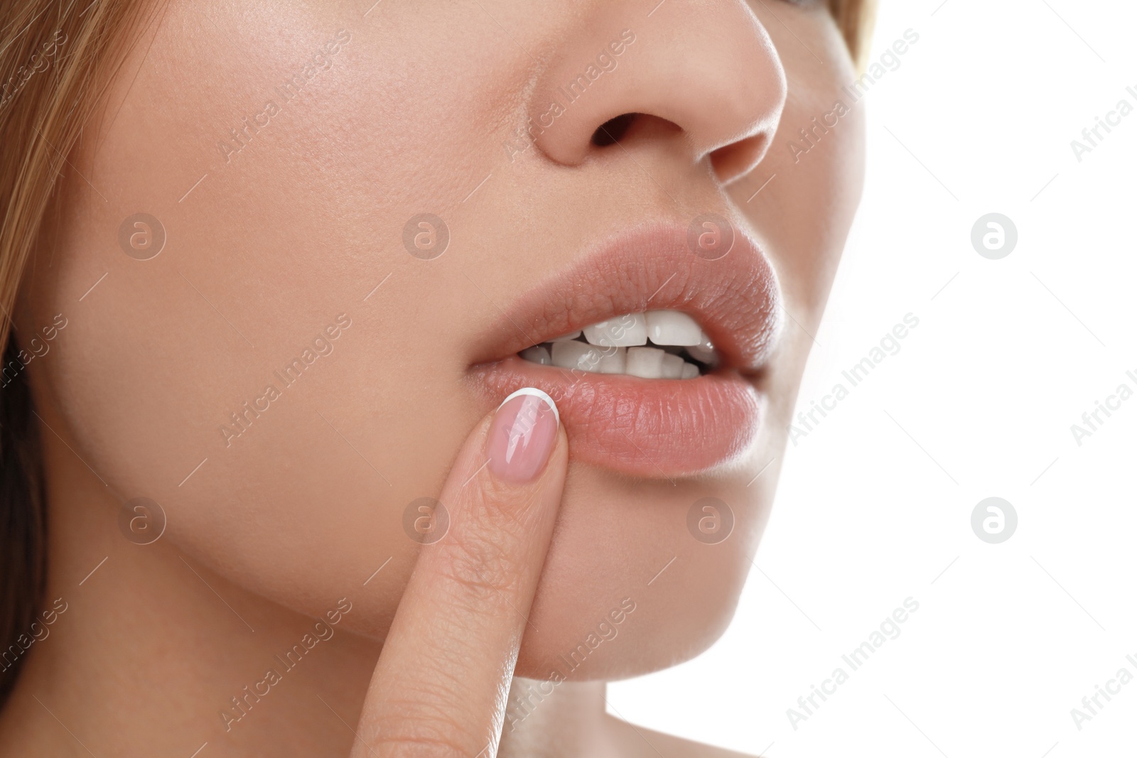 Image of Young woman with cold sore applying cream on lips against white background, closeup