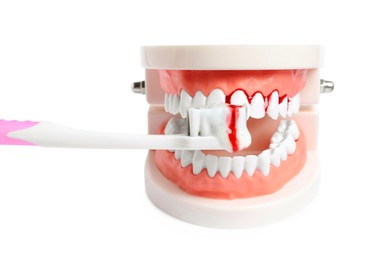 Photo of Model of jaw, brush and toothpaste foam with blood on white background. Gum problems