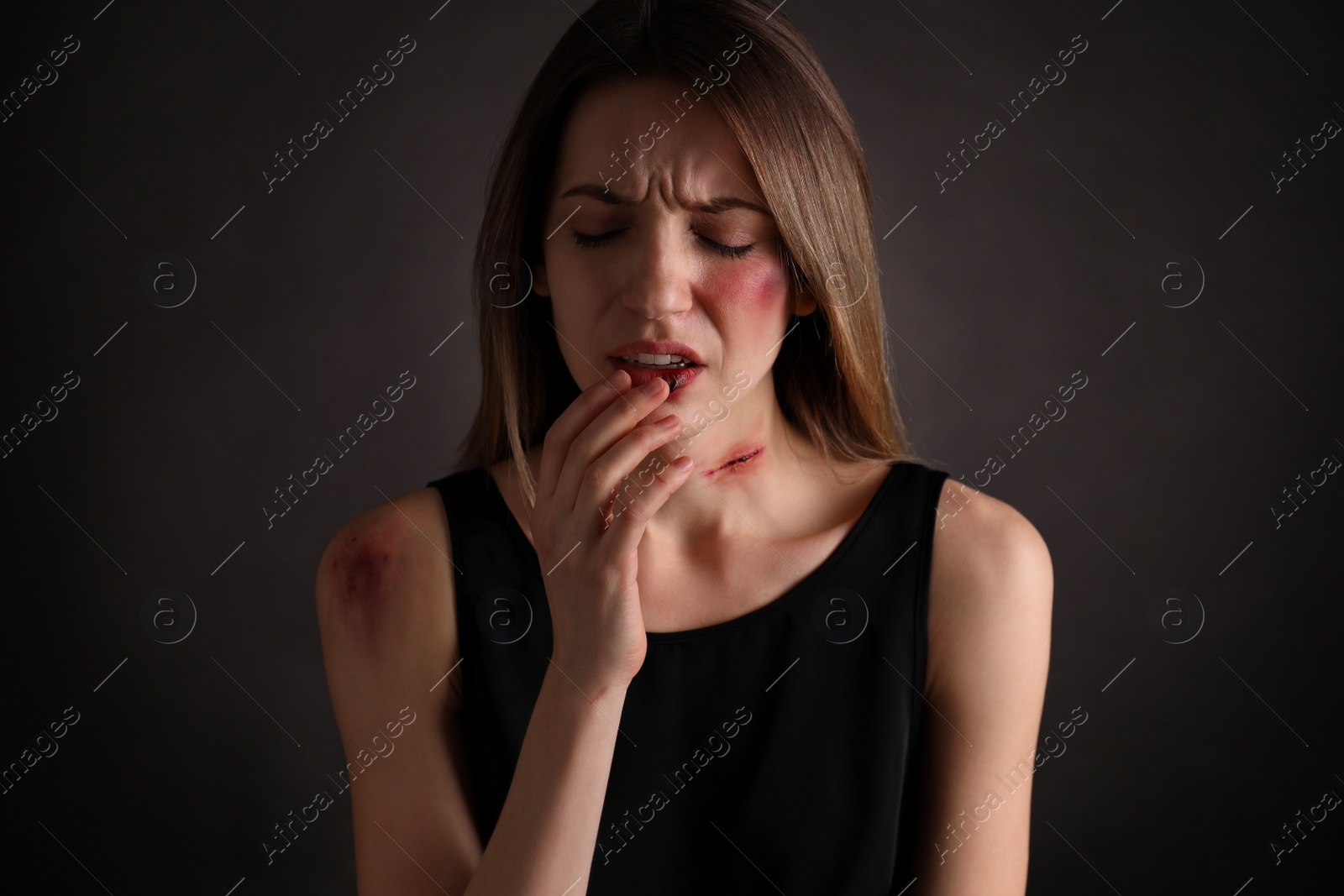 Photo of Woman with facial injuries on black background. Domestic violence victim