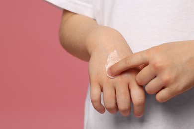 Photo of Child applying ointment onto hand against pink background, closeup