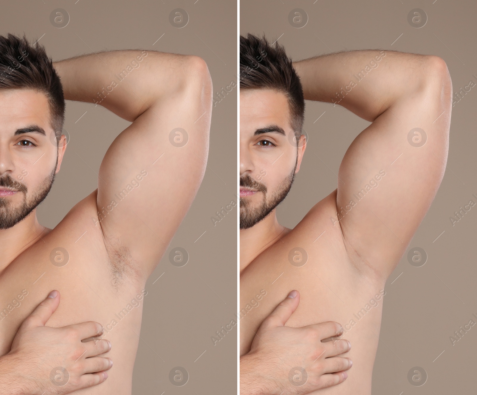 Image of Collage of man showing armpit before and after epilation on light brown background