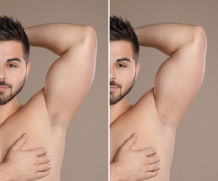 Image of Collage of man showing armpit before and after epilation on light brown background