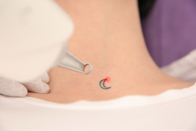Photo of Young woman undergoing laser tattoo removal procedure in salon, above view