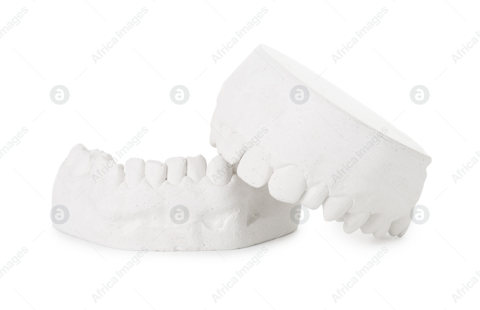 Photo of Dental model with gums isolated on white. Cast of teeth