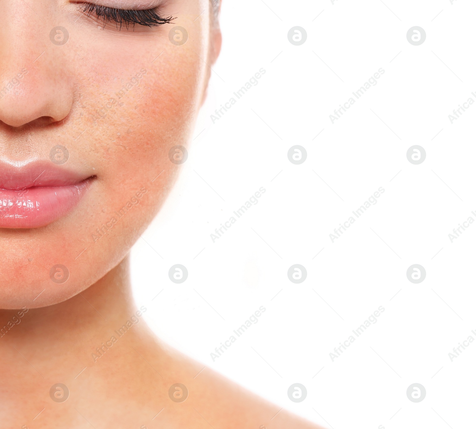 Image of Young woman with dry skin on white background, closeup