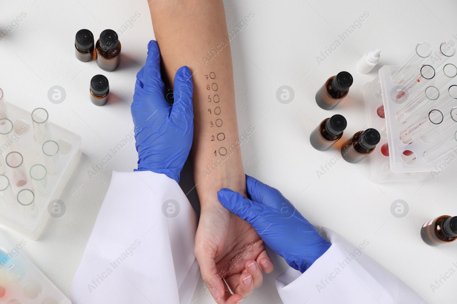 Photo of Doctor doing skin allergy test at light table, top view