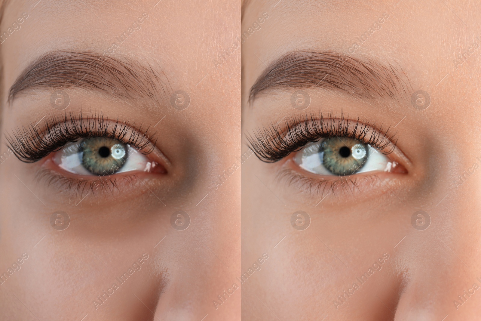 Image of Collage with photos of tired woman with dark circle under eye and after rest, closeup