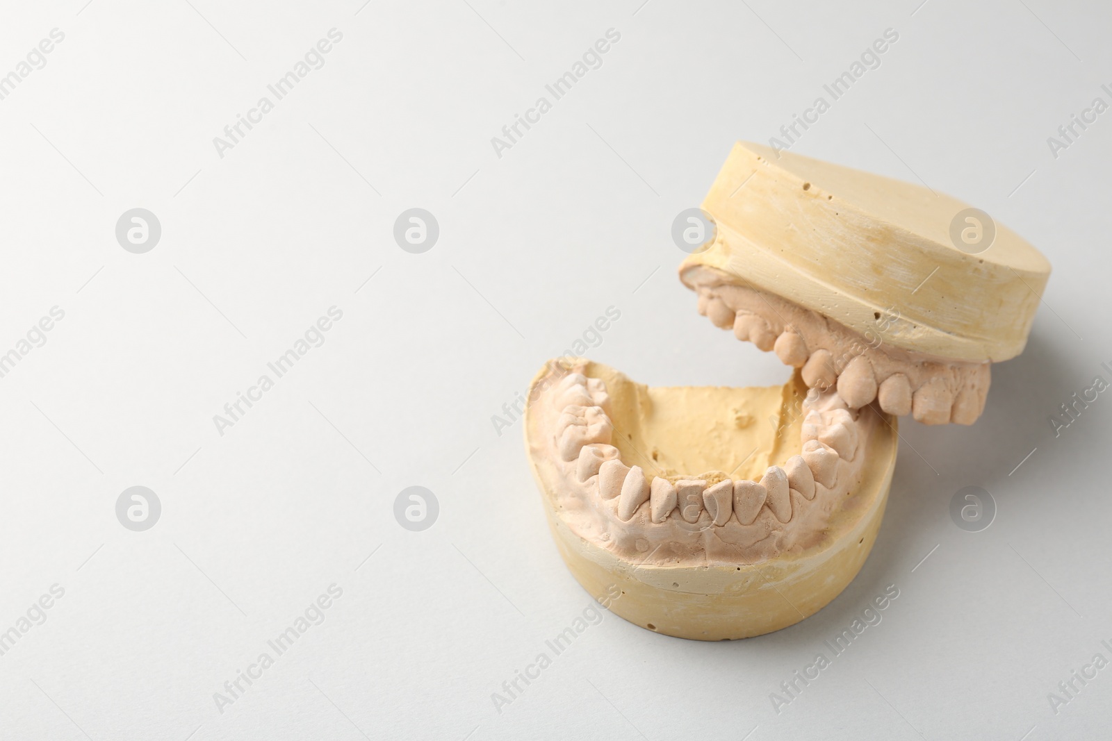 Photo of Dental model with gums on light grey background, space for text. Cast of teeth