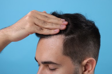 Man examining his head on light blue background, closeup. Dandruff problem
