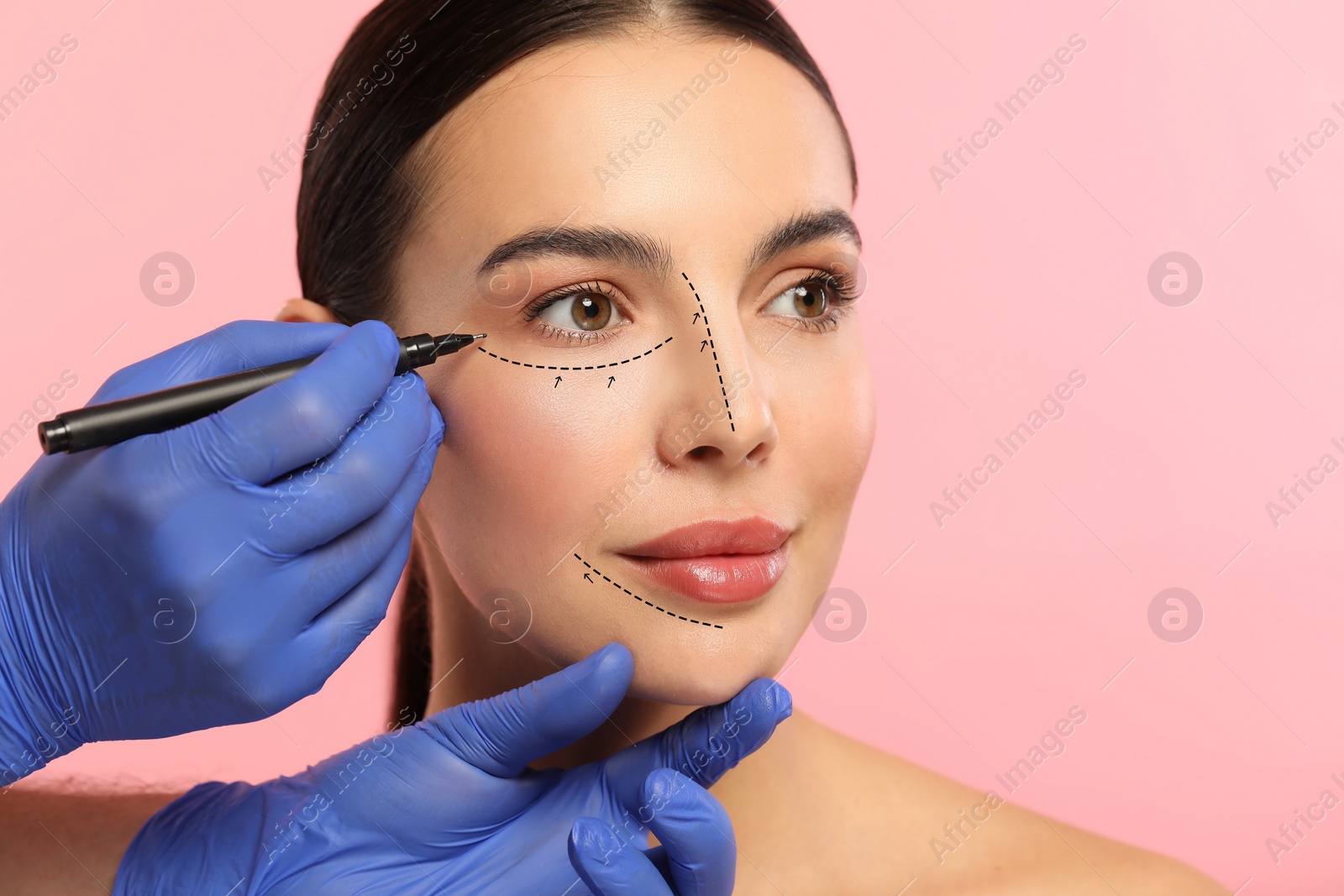 Image of Woman preparing for cosmetic surgery, pink background. Doctor drawing markings on her face, closeup