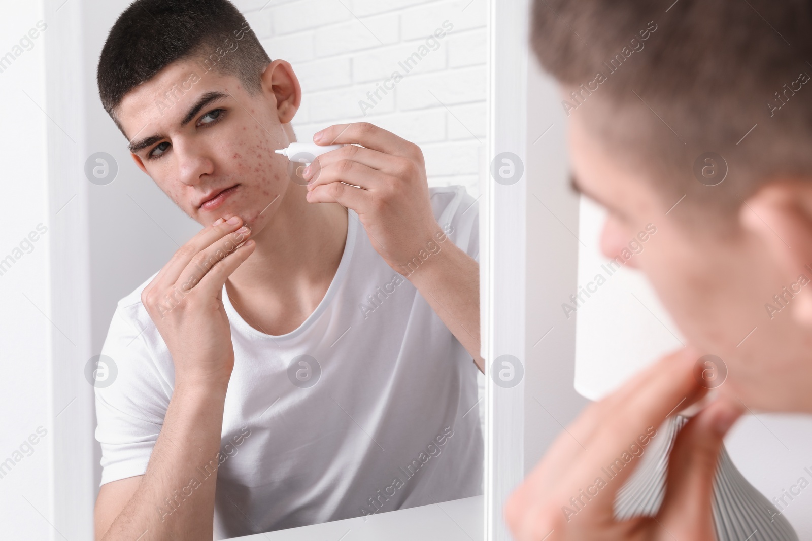 Photo of Young man with acne problem applying cosmetic product onto his skin near mirror indoors