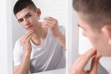 Photo of Young man with acne problem applying cosmetic product onto his skin near mirror indoors