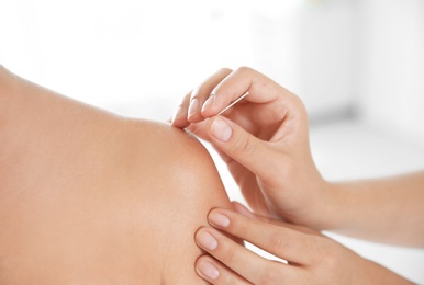 Young woman undergoing acupuncture treatment in salon, closeup