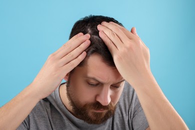 Photo of Man with dandruff in his dark hair on light blue background, closeup