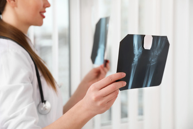 Photo of Orthopedist examining X-ray pictures near window in office, closeup