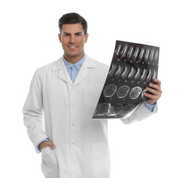 Orthopedist holding X-ray picture on white background