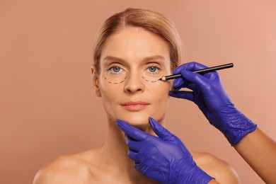 Photo of Doctor with pencil preparing patient for cosmetic surgery operation on light brown background