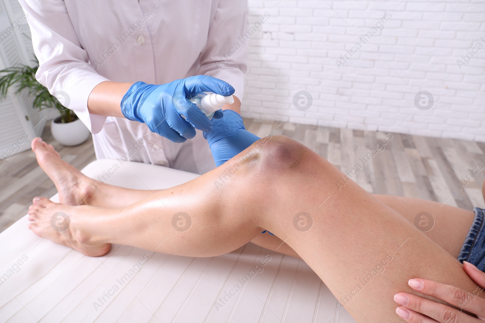 Photo of Doctor spraying woman's knee bruise in hospital, closeup