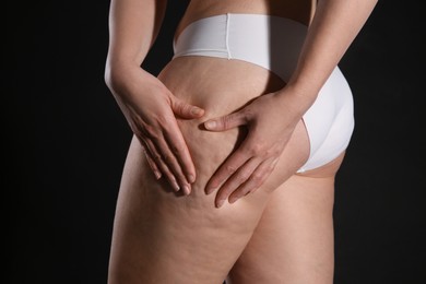 Woman with cellulite on black background, closeup