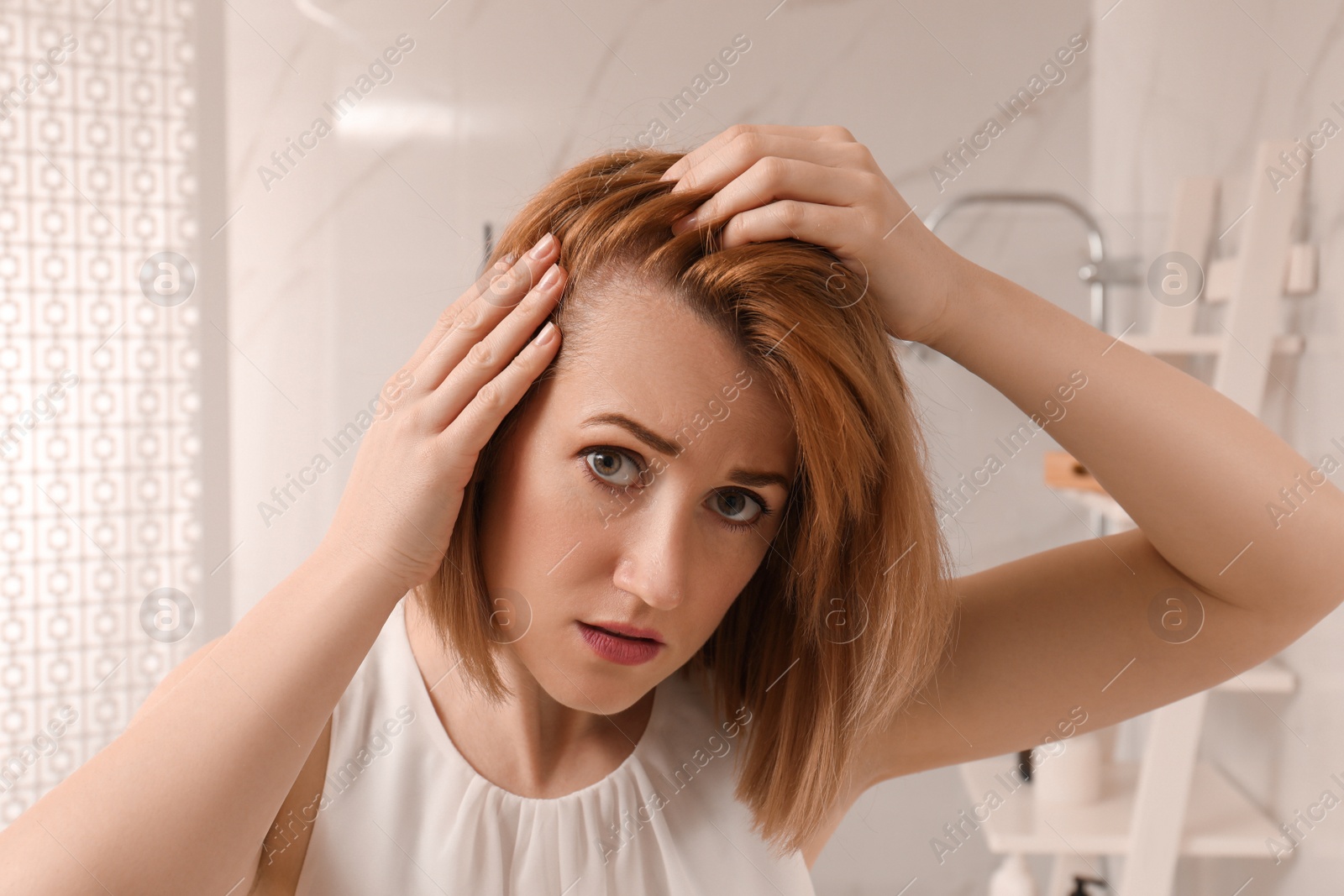 Photo of Sad woman suffering from baldness at home