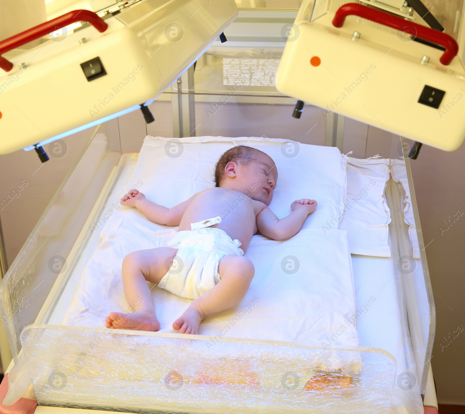 Photo of Newborn child under ultraviolet lamps in hospital