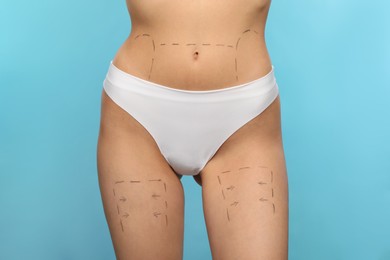 Slim woman with markings on body before cosmetic surgery operation on light blue background, closeup